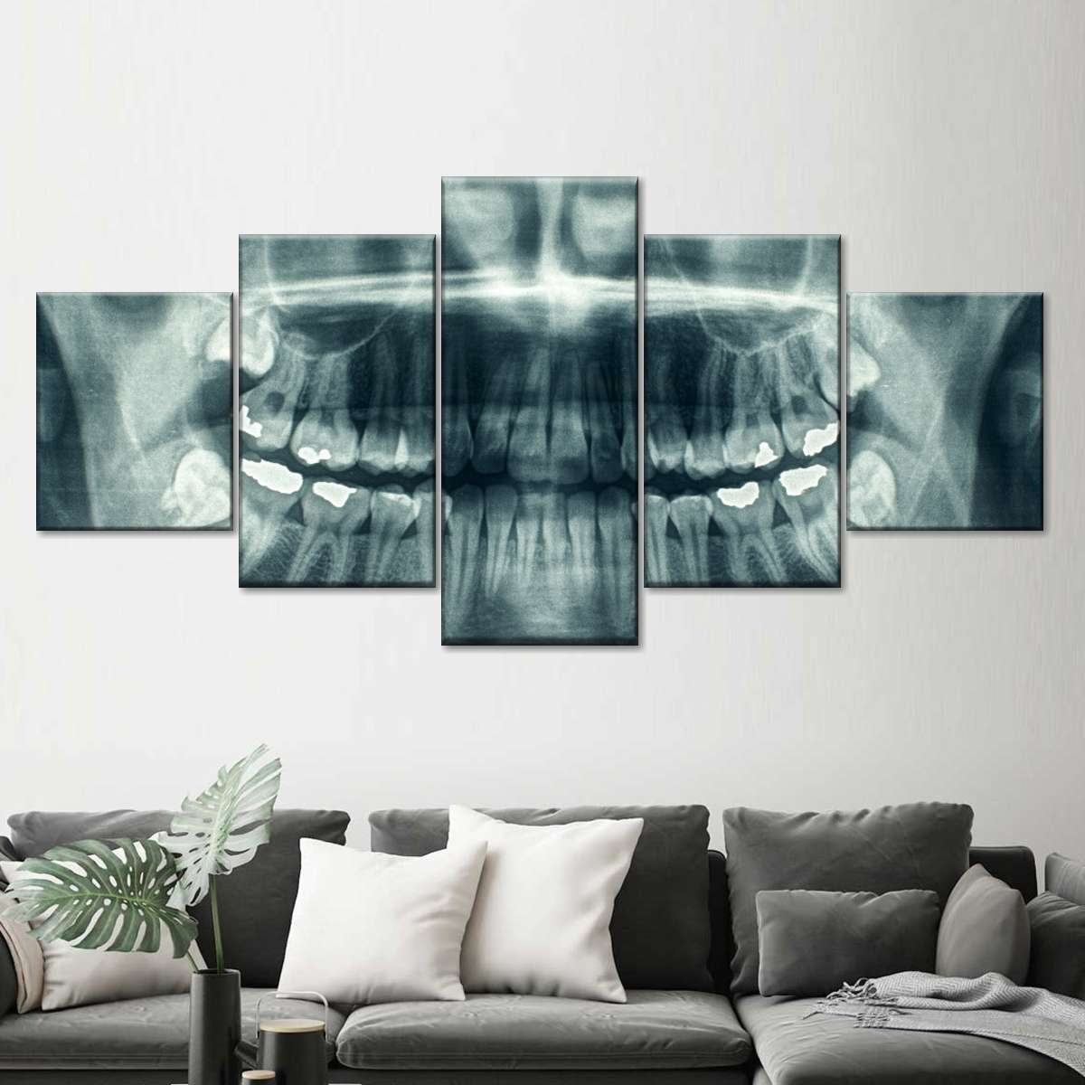 Dental X Ray Leinwandbilder Kunstdrucke Rahmen
